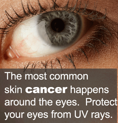 skin cancer